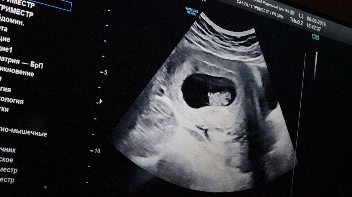Медицинские показания — заболевания у женщины, которые несут большой вред как для нее, так и для здоровья плода